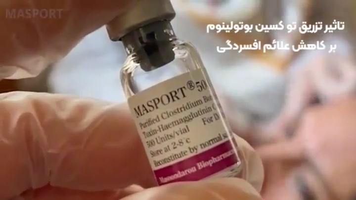 تاثیر تزریق توکسین بوتولینوم مصپورت بر کاهش علائم افسردگی