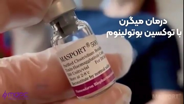 تاثیر توکسین بوتولینوم دردرمان میگرن