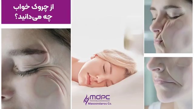 تاثیر تزریق توکسین در چروک های خواب