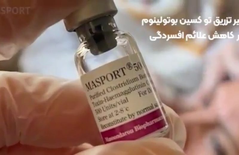 تاثیر تزریق توکسین بوتولینوم مصپورت بر کاهش علائم افسردگی