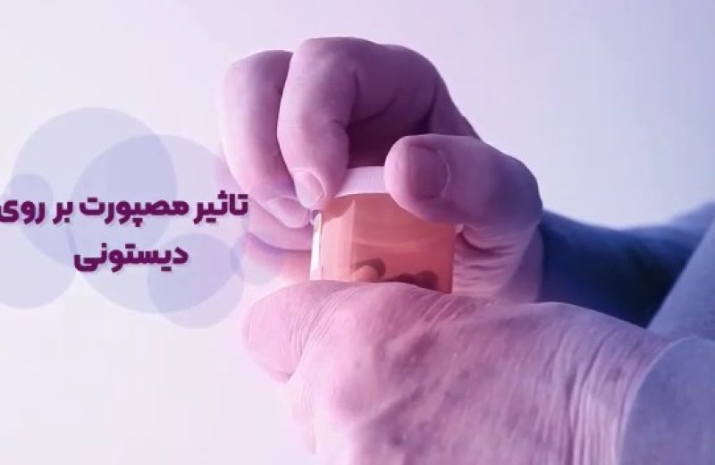 تاثیر-توکسین-بر-دیستونی