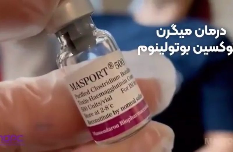 تاثیر توکسین بوتولینوم دردرمان میگرن