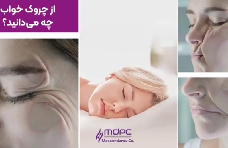  تاثیر تزریق توکسین در چروک های خواب