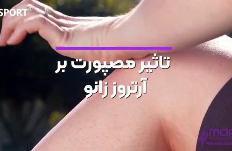 کاربرد توکسین بوتولینوم در درمان آرتروز زانو